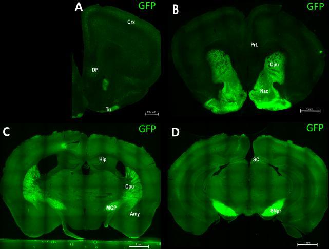 Rysunek 2 Barwienie immunofluorescencyjne na obecność GFP (zielony) u myszy Oprd1/Oprm1 D1-KD. Zdjęcia mikroskopowe skrawków mrożeniowych o grubości 40 µm przy powiększeniu 10.