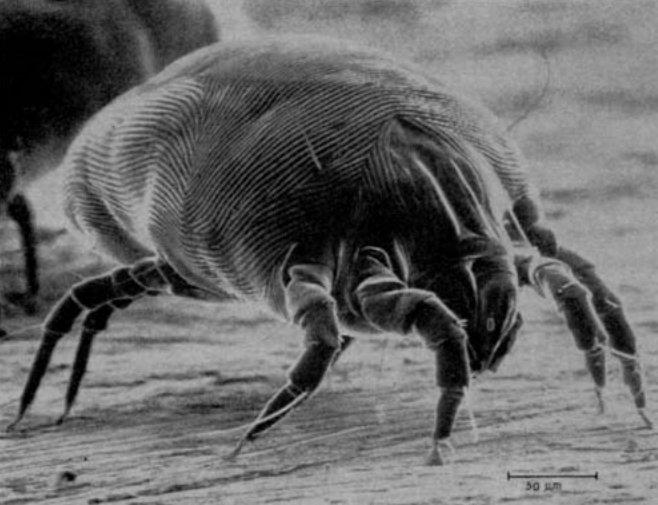 Hyperlink (internal) Dermatophagoides pteronyssinus (zrodlo Wikipedia). Pamietaj, ze uczula nie sam pajeczak, ale jego male odchody (kuleczki fekalne).