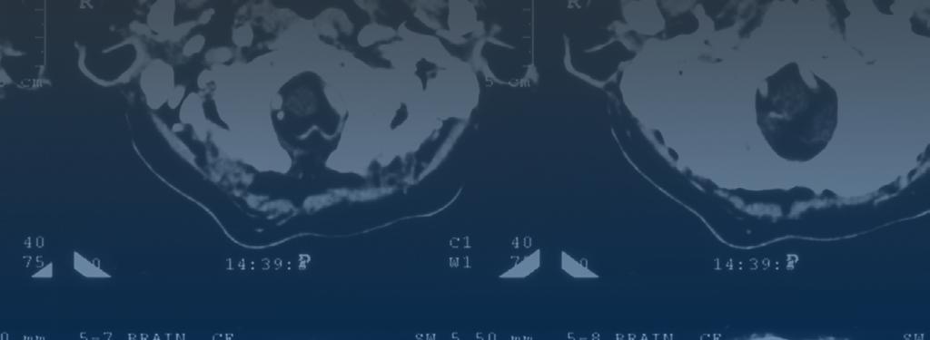 FEEDBACK MEDICAL LTD www.fbkmed.com SPIS TREŚCI O KLIENCIE 1. O KLIENCIE 2 2. ROLA FUTURE PROCESSING 2 3. REZULTATY WSPÓŁPRACY 3 4. BIZNESOWA STRONA PROJEKTU 4 5. WYZWANIA 4 6. NASZE WNIOSKI 5 7.