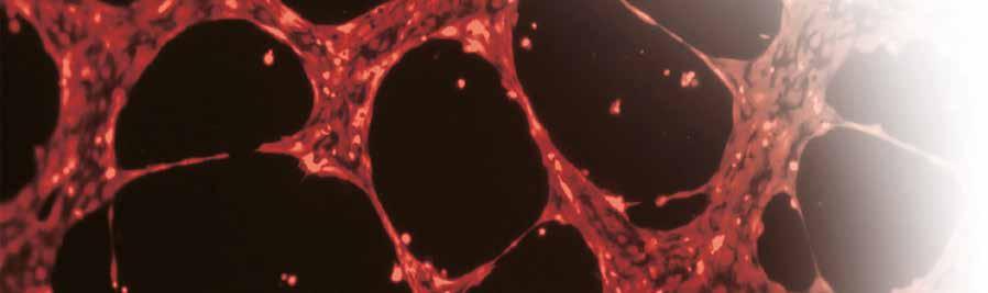 Angiogeneza Obserwacje procesu tworzenia rurkowatych struktur naczyń krwionośnych i