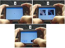 Deep Brain Stimulation fmri
