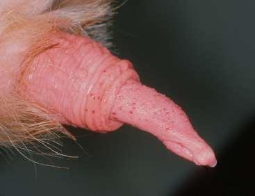 Infectious pustular vulvovaginitis (IPV)