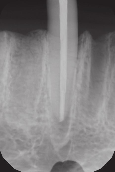Five slices: axial, frontal, sagittal, transsectional, and contiguous, and additionally the possibility of adjusting the plane of the X-ray beam path through a scanned object, make the confirmation