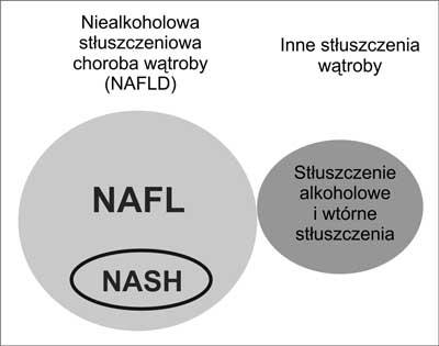 stłuszczenia hepatocytów obserwuje się w różnym nasileniu i w różnej konstelacji (4, 5): zapalenie zrazikowe, martwicę hepatocytów, hialinę Mallory ego, zwyrodnienie glikogenowe jąder,