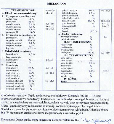 B 12 w przewodzie pokarmowym poprzez pomiar radioaktywności wydalanej z moczem wit. B12 * Co. norma po doustnym podaniu na czczo 1 ug wit.