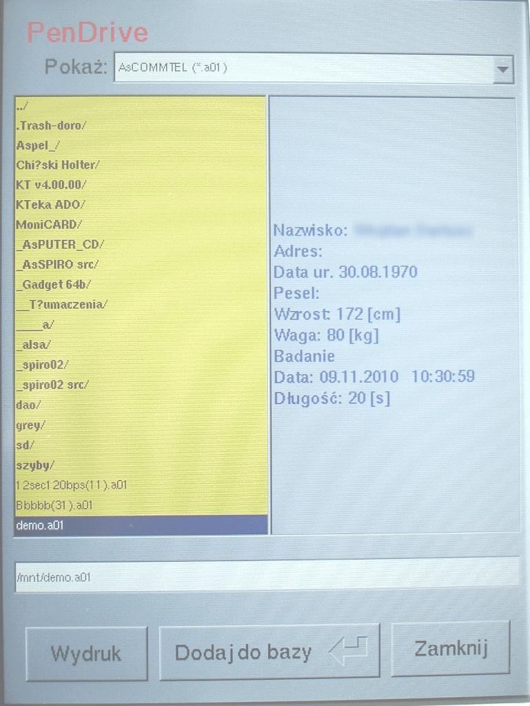Polecenie <Wydruk> powoduje wydrukowanie badania na wewnętrznej drukarce aparatu. Polecenie <Dodaj do bazy> powoduje dodanie wczytanego badania do bazy aparatu. Rys. 11. Eksploracja PenDrive a 11.3.