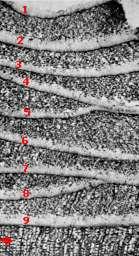 peryderma 1-9 -