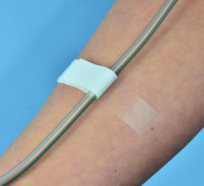 repozycji i korekcji położenia drenu dzięki zastosowanym rzepom pokryty hipoalergicznym klejem posiada znakomite właściwości przylepne i dużą wytrzymałość mechaniczną, co zapobiega przedwczesnemu i