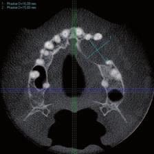 poddanych szeregom badań klinicznych: ogólne badanie lekarskie, EKG; radiologicznych: rtg klatki piersiowej oraz laboratoryjnych: morfologia z rozmazem, OB, CRP, przeciwciała anty HIV1/HIV2, anty