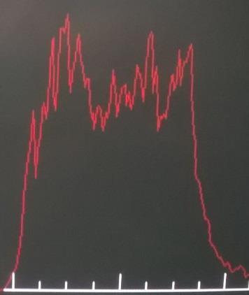 [N] 38,4 ± 9,7