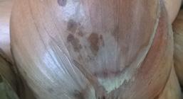 siew; prawidłowe nawożenie azotem i potasem; regularne nawadnianie upraw (15 mm opadu) przed siewem dobór odmian jednostożkowych; w trakcie uprawy głębsze sadzenie dymki lub rozsady w trakcie