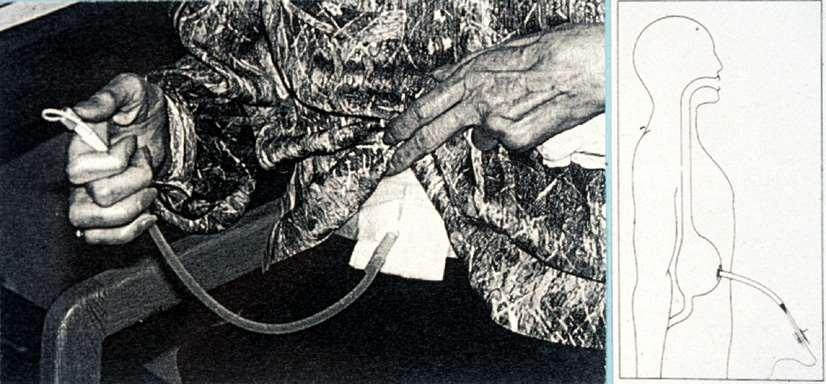 PEG Gauderer &