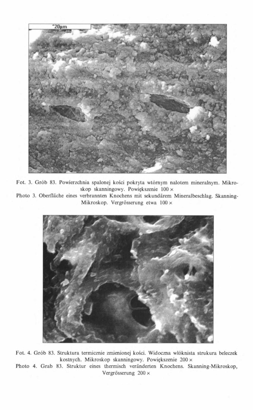Fot. 3. Grób 83. Powierzchnia spalonej kości pokryta wtórnym nalotem mineralnym. Mikroskop skanningowy. Powiększenie 100 x Photo 3.