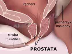 krokowy - prostata