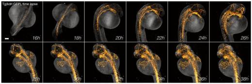 10 min. SPIM signal (yellow) is superimposed on tomographic reconstruction (gray).