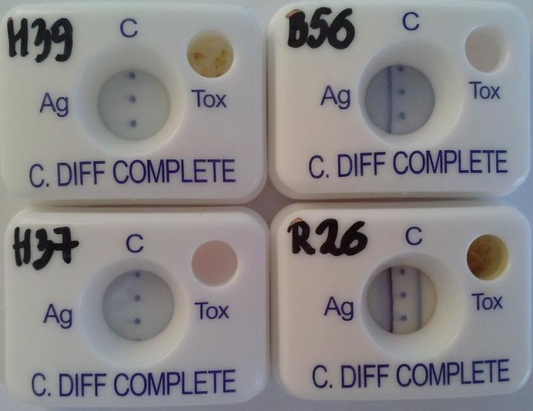 Test kasetkowy immunoenzymatyczny (firma Tech-Lab, USA) Płytki po dodaniu substratu (zdjęcie własne). Linia niebieska oznacza wynik dodatni. W próbce B56 stwierdzono obecność antygenu GDH.