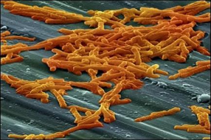 WNIOSKI Nadużywanie antybiotyków powoduje pojawianie się biegunek o etiologii Clostridium difficile u pacjentów pozaszpitalnych w różnym wieku Nawroty CDI nie są związane z opornością