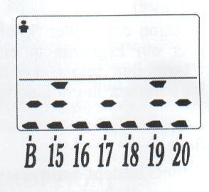 1 do 5 (Bingo): Numer celu to dowolny z 1, 2, 3, 4 lub 5. 7. ##: Wynik drużyny dla Baseball i Penny. 8. Ho # lub #H: Otwór 1, 2... itd. 1, 2, 3... itd. Otwór do gry w golfa. 9.