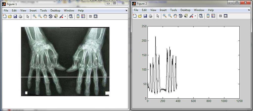 Skrypt może mieć postać. %Linescan 1 [L1]= imread('d:\\med_image\\rtg_01.