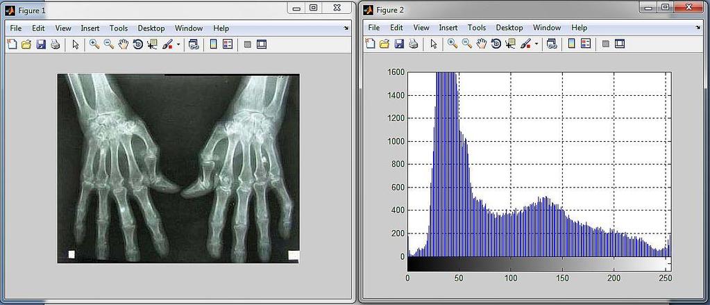 Rys.5.1. Przetwarzany obraz oraz jego histogram W pokazanym przykładzie mamy zdjęcie rentgenowski dłoni.