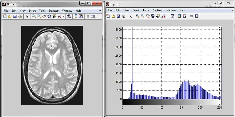 Przetwarzany obraz oraz jego histogram pokazane są na kolejnym rysunku. Rys.5.4. Obrazy wejściowy i jego histogram W oknie Figure 2 pokazany jest histogram obrazu.