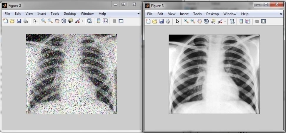 wykorzystana została funkcja rgb2gray(), która dokonuje transformacji mapy kolorów, w tym przypadku model RGB zostaje przetransformowany do typu grayscale.