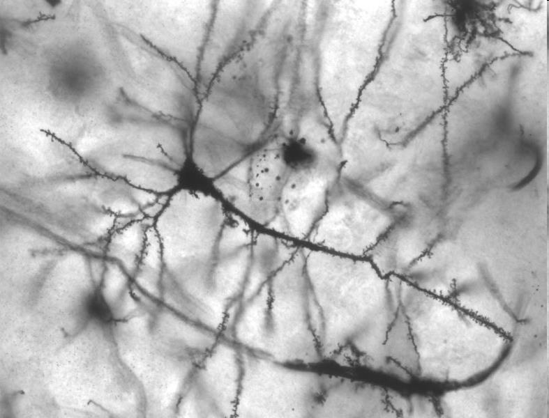 Neurony odbieranie i przekazywanie