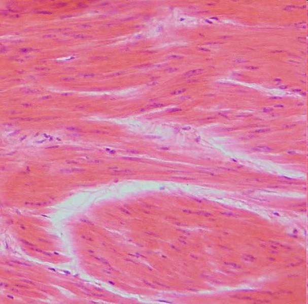 Mięśnie gładkie miocyty wrzecionowate komórki filamenty aktynowe i miozynowe brak sarkomerów i miofibryli (brak