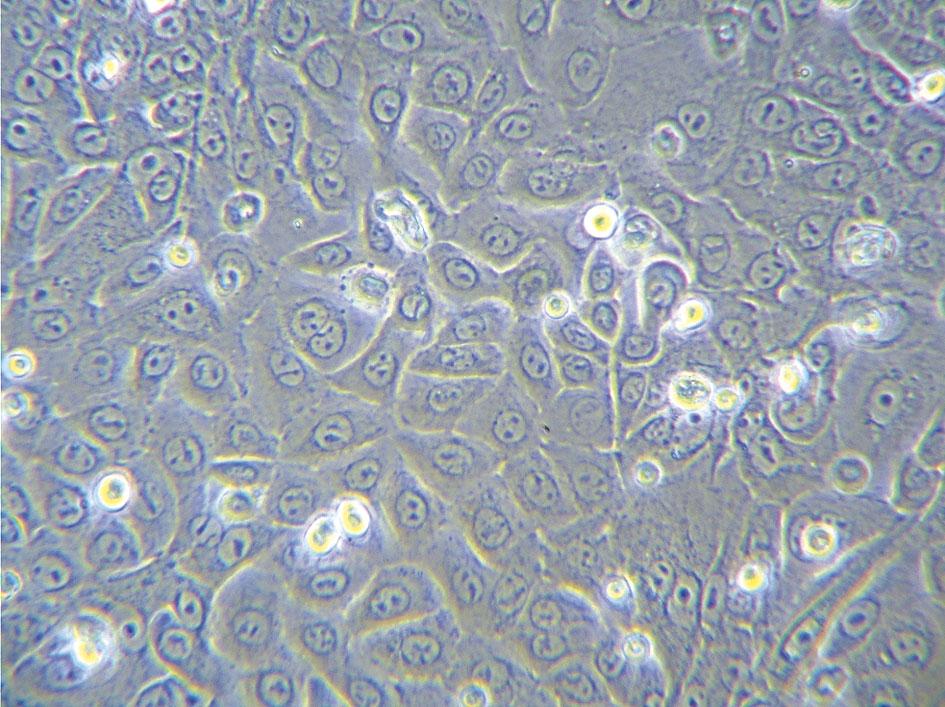 Hodowla keratynocytów i komórek macierzystych Dodanie do pożywki jonów wapnia indukuje wiele strukturalnych i biochemicznych zmian charakterystycznych dla suprabazalnych warstw naskórka.