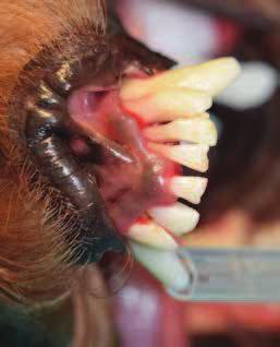 Badaniem periodontologicznym stwierdzono ruchomość drugiego stopnia zębów 401, 402 oraz 403, natomiast w badaniu radiologicznym 50% zanik kości wyrostka zębodołowego tej okolicy, natomiast w