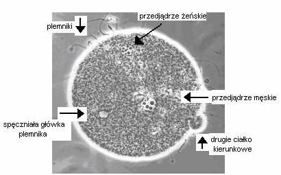 32 W przypadkach wymagających sprawdzenia tzw. wariantów morfologicznych chromosomów (heteromorfizmów) dodatkowo stosowano standardowe barwienie prążków C i/lub NOR.