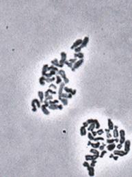 ). 2.3. Fluorescencyjna hybrydyzacja in situ FISH 2.3.1.