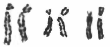 W plemnikach mężczyzn z grupy kontrolnej średnia częstość hiperhaploidii różnych chromosomów wynosiła 4%, a aberracji struktury chromosomów 5% (w tym 2% stanowiły chromosomy markerowe).