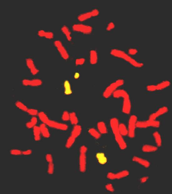 51 Ryc. 9. Sygnały FISH identyfikujące chromosom 20 na płytce metafazowej limfocytów u nosiciela dodatkowego chromosomu markerowego 46,XY[96]/47,XY,+mar[4].