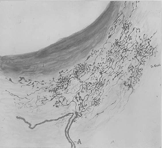 Serce zastawka Zatoka szyjna nasierdzie rozszerzony odcinek tętnicy szyjnej wewnętrznej