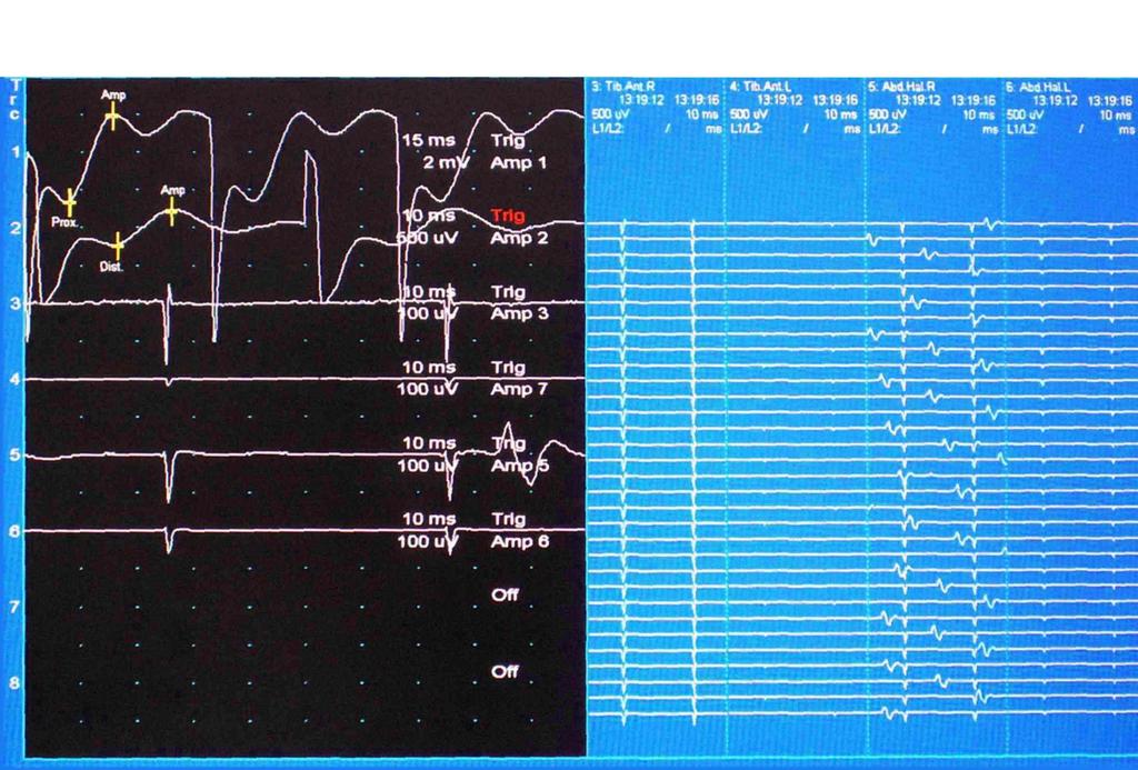 D wave i