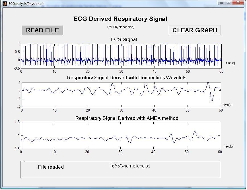 Rys.12 Otrzymane wykresy dla pliku 16539-normalecg.txt Rys.