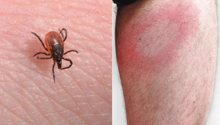 Zarządu Szpitala Specjalistycznego w Kościerzynie o zmniejszenie