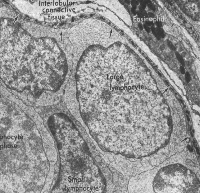 grudek chłonnych wyłącznie limfocyty T nie zachodzą reakcje immunologiczne skierowane przeciw obcym antygenom funkcja: szkoła dla niedojrzałych