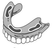 Dzwoń: Beata 718-383-7207 ***** ***** ***** REPAIRS of DENTAL PROSTHESIS If you are in need of immediate repairs of your dental prosthesis you do not have to