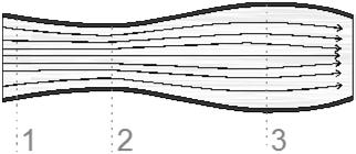 Rozgałęzienie naczyń v D, v d prędkości liniowe Przykład 1 Tętnica o średnicy 10 mm na skutek zmian miażdżycowych zwęziła się w pewnym miejscu do 5 mm. Prędkość przepływu w zdrowej tętnicy wynosi 0.