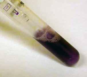 Brak protein na narzędziach po myciu maszynowym. WWRyc. 13. Obecność protein na narzędziach niepoddanych dezynfekcji i myciu wstępnemu przed myciem maszynowym.