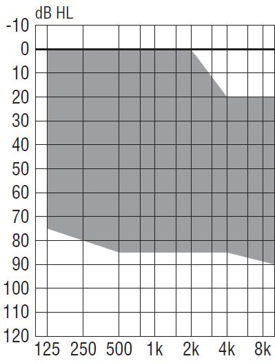 programów 6 Rozmiar baterii 312 Pobór prądu 1,0 ma Aparat numer 2 Aparat cyfrowy, zauszny Zalecany zakres dopasowania (dopasowanie standardowe): Parametry według normy PN-EN 60118-0