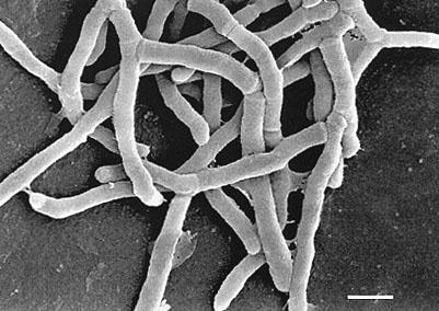 Actinomyces israeli This species is