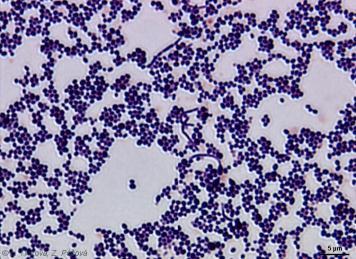 Zoospory namażają się tworząc długie łańcuszki przypominające strzępki (filamenty) i penetrują do naskórka (epidermis) a następnie proces rozprzestrzenia się we wszystkich kierunkach.