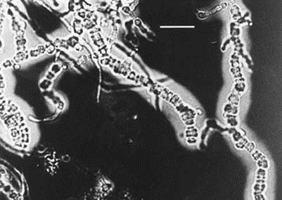 Dermatophilus congolensis Gram-positive branching filaments dividing by transverse and longitudinal septa to form