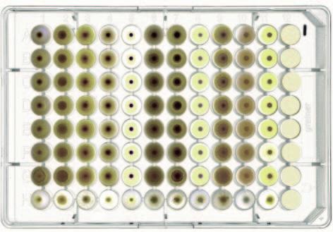 Ocena składu zanieczyszczeń gleb skażonych TPH i WWA pod kątem opracowania technologii ich bioremediacji 120 Gleba kontrolna MTC [%