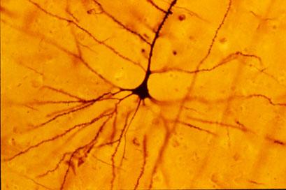 Budowa neuronów biologicznych Mechanizmy biofizyczne Rysunek: Neuron piramidalny z kory