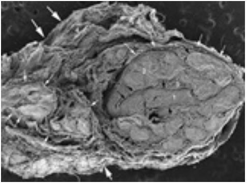 elastyczne perineurium