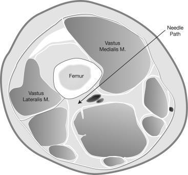 ARTERY AND